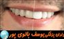 درمان ریشه دندان در کلینیک دکتر بالوی پور