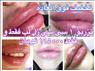 تزريق ژل امريكايي قيمت فوق العاده استثنايي